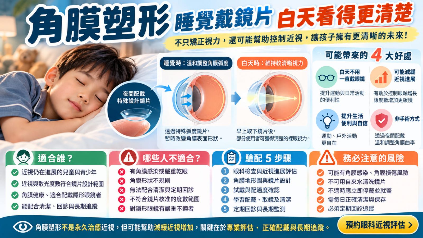角膜塑形完整指南:適合年齡、近視控制、驗配流程與風險