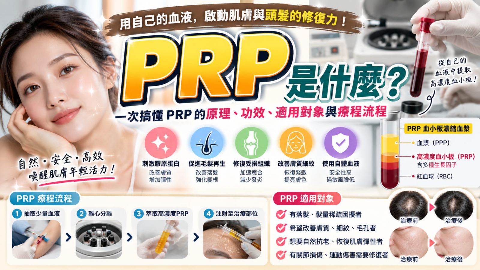 PRP是什麼?PRP注射原理、適用情況、治療流程、費用與注意事項一次看懂